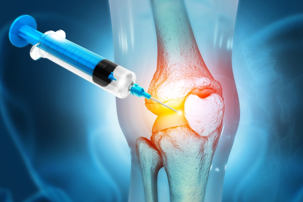 Knee PRP Therapy
