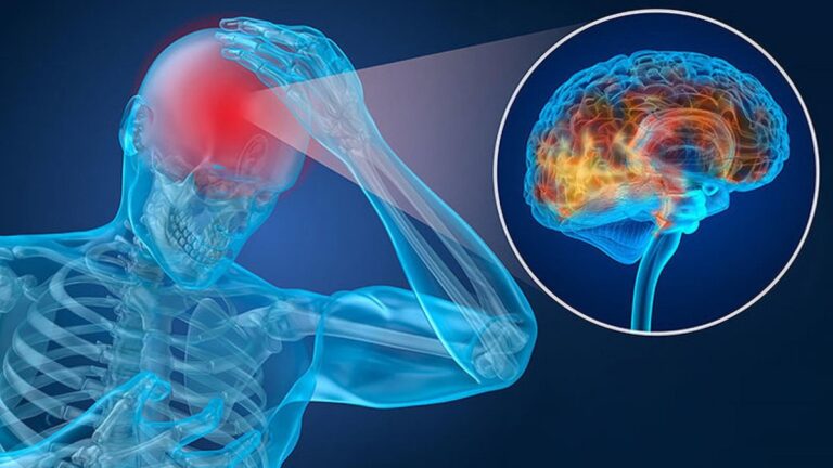 Traumatic Brain Injury